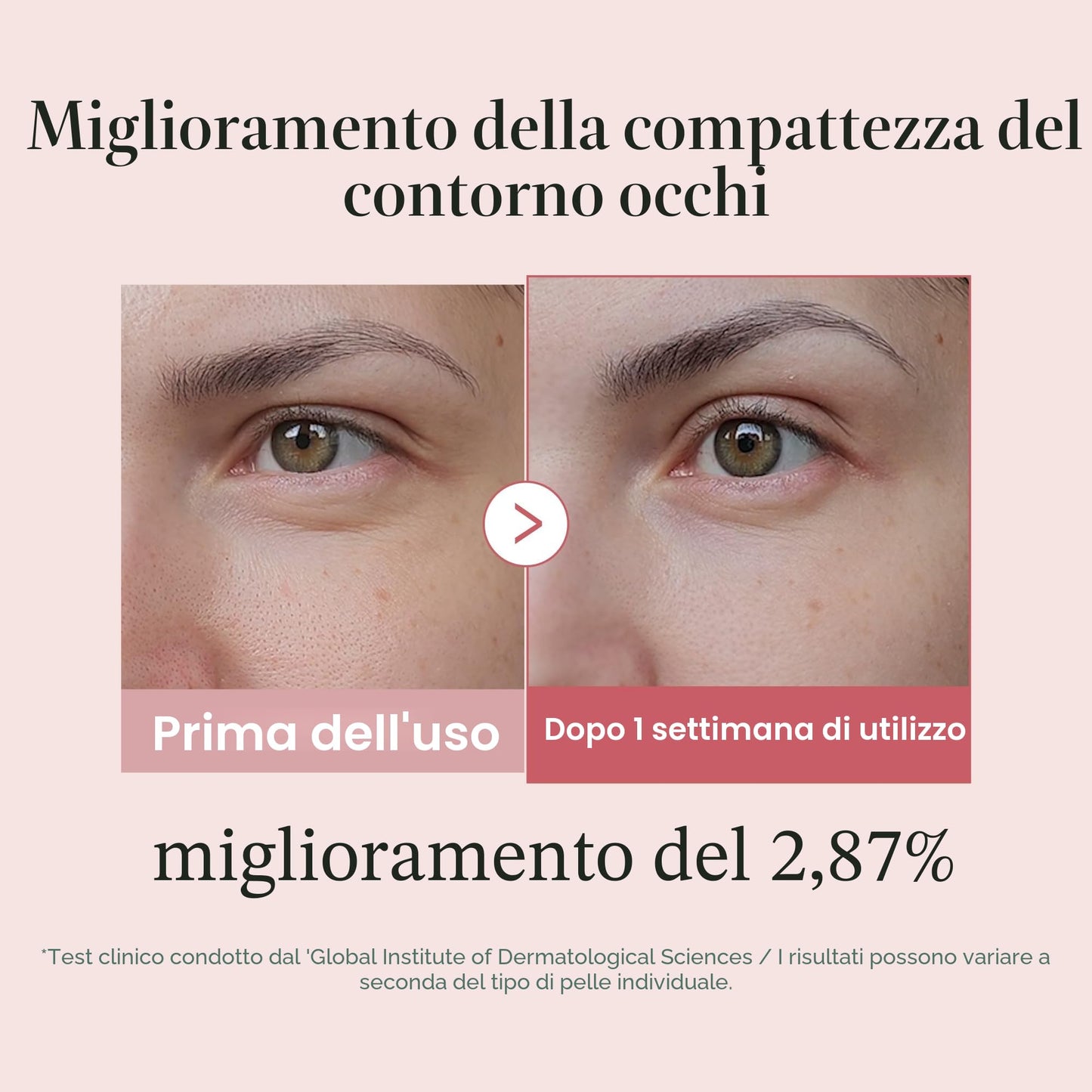 medicube Salmon DNA PDRN Pink Peptide Eye Serum 1,01 fl.oz – Siero occhi con Niacinamide e Retinolo puro per linee sottili e tono irregolare