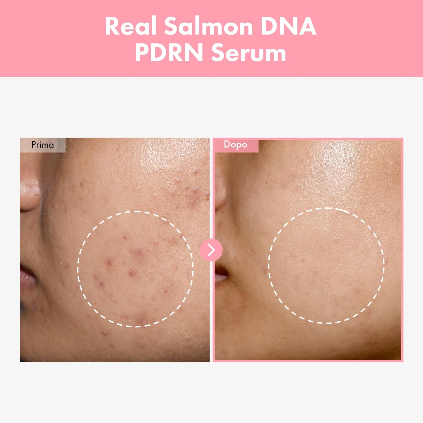 TOSOWOONG Siero Pink Peptide PDRN con 10.320 ppm di DNA di Salmone, 12 Peptidi, Niacinamide, Idratante, Illuminante, Uniformante, Tonificante, Skincare Coreana, 33ml